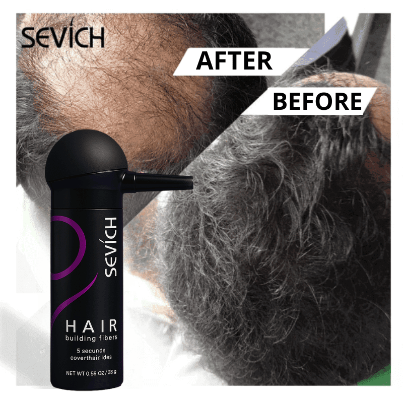 Keratin Fiber Powder - Anti-Baldness - Sevich™